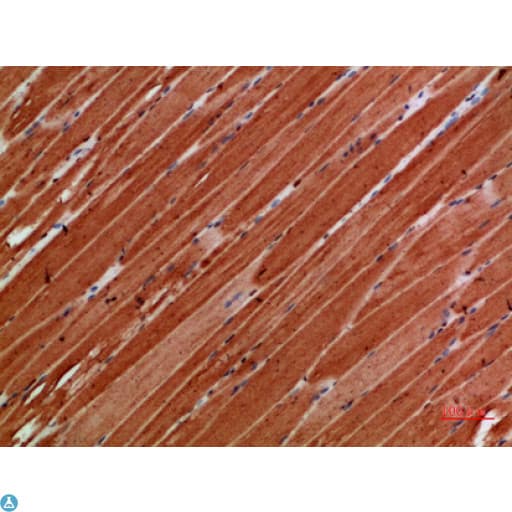 Polyclonal Rabbit anti-Human TTN / Titin Antibody (aa161-210, IHC)
