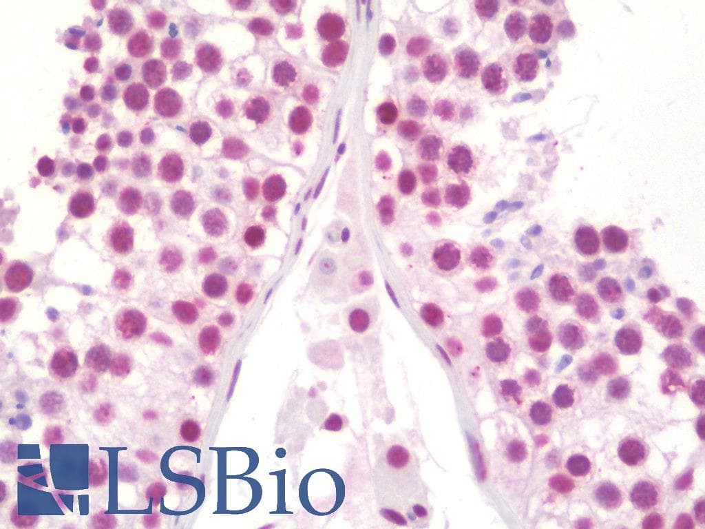 IHC-plus™ LOX / Lysyl Oxidase Antibody (clone 9A11)
