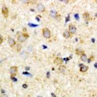 HIF1AN Antibody