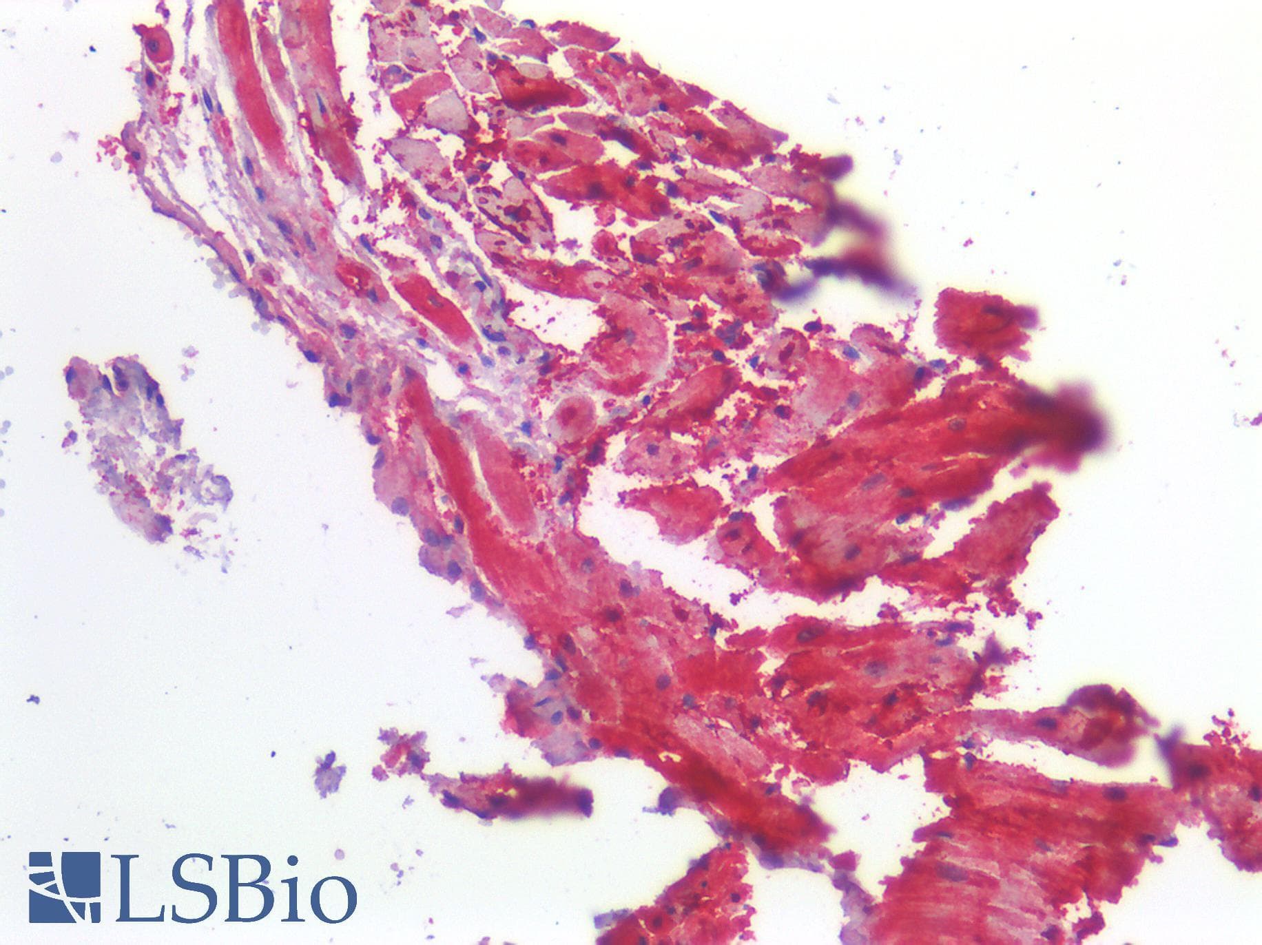 IHC-plus™ ROR1 Antibody (C-terminal)