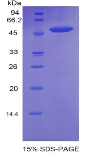 Rat CDH13 / Cadherin 13 Protein (Recombinant His-GST)