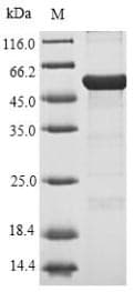 Pseudomonas putida xylE Protein (Recombinant 10His-SUMO, N-terminus + Myc, C-terminus)
