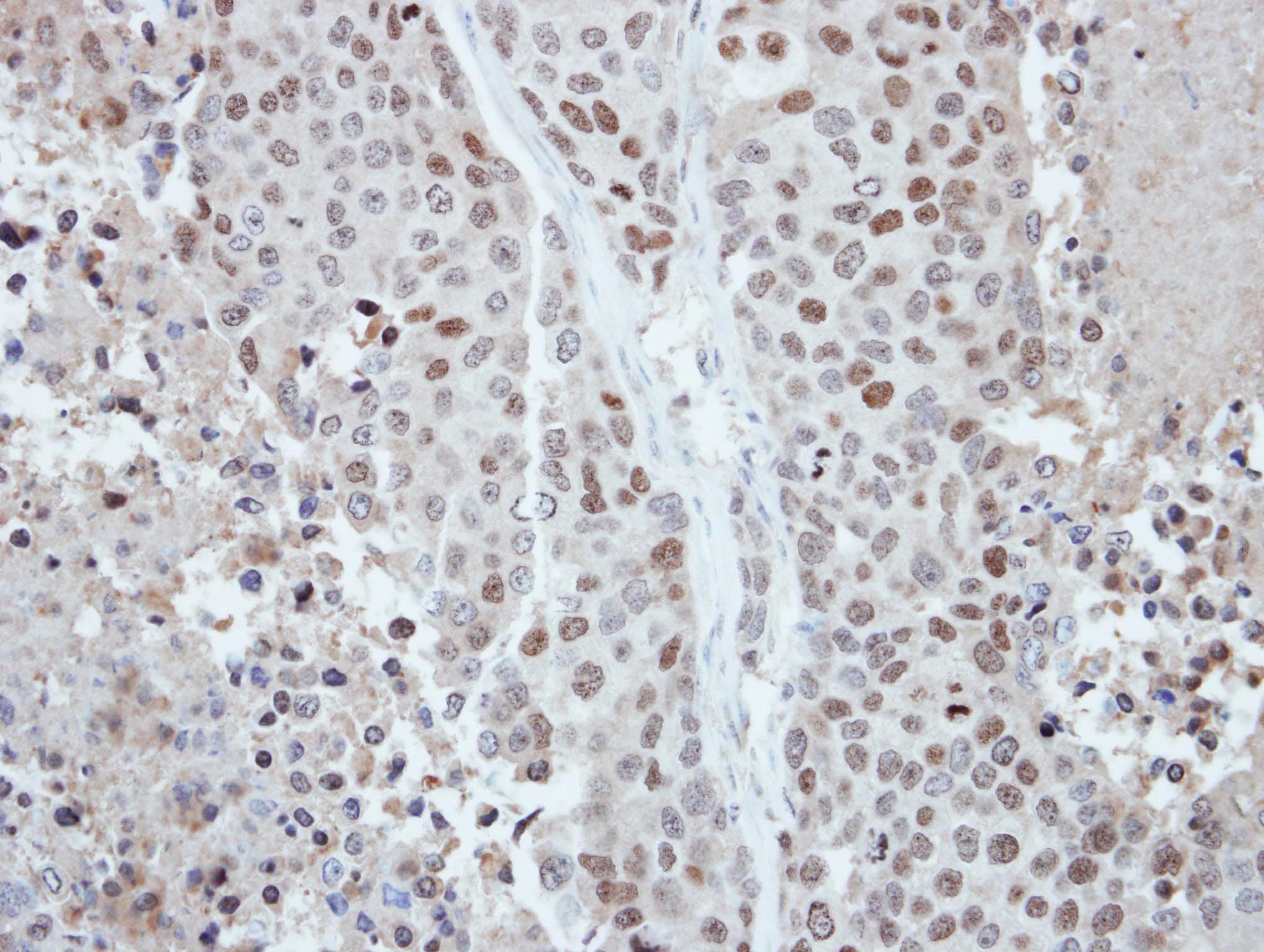 CDYL Antibody