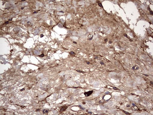 IL1RN Antibody (clone OTI2B1)