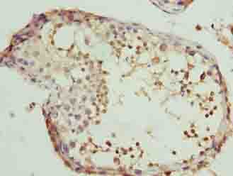 Polyclonal Rabbit anti-Human CLGN / Calmegin Antibody (IHC, WB)