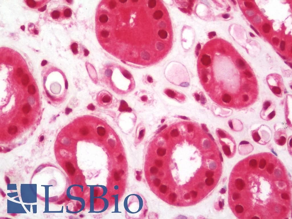 IHC-plus™ Polyclonal Rabbit anti-Human IKZF2 / HELIOS Antibody (aa25-75, IHC, WB)