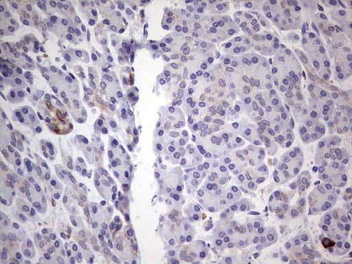 Monoclonal Mouse anti-Human PKM2 Antibody (clone 11B11, IHC, WB)