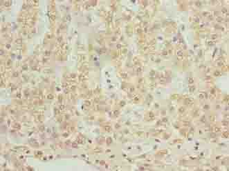 SLC12A4 / KCC1 Antibody