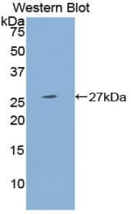 PSG1 / CD66f Antibody (aa202-401, FITC)