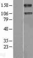Human IGF1R / IGF1 Receptor Protein (Over-Expression Lysate Myc-DDK (Flag))