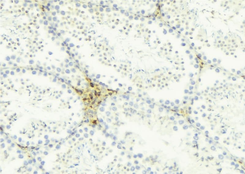 AKAP1 / AKAP Antibody