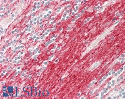 IHC-plus™ CLDN11 / Claudin 11 Antibody (aa158-207)