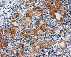 LIPG / Endothelial Lipase Antibody (clone OTI3C7)