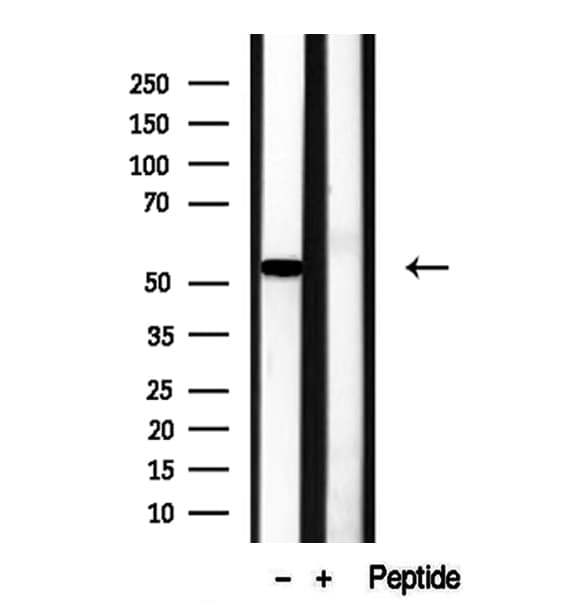 RCN2 Antibody