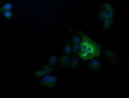 TRIM38 Antibody (aa1-265, clone OTI15A3, Carrier-free)