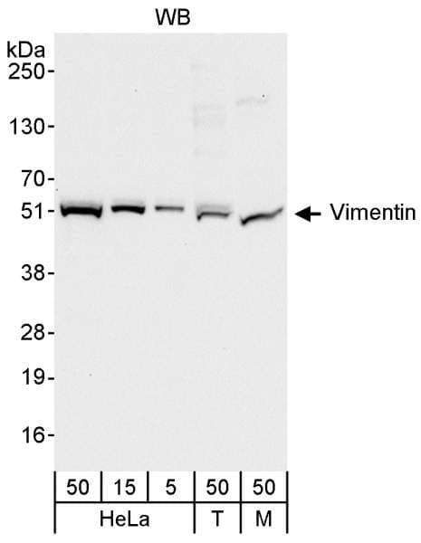 Vimentin Antibody (aa416-466)