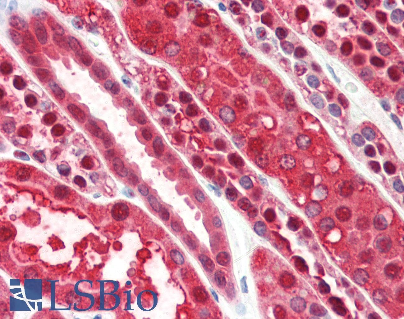 IHC-plus™ PEBP1 / RKIP Antibody (aa70-83)
