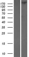 TNKS1BP1 / TAB182 Protein (Over-Expression Lysate Myc-DDK (Flag))