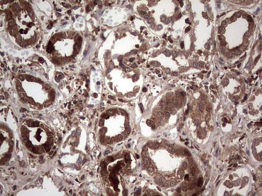 LGALS3 / Galectin 3 Antibody (clone OTI7G9)