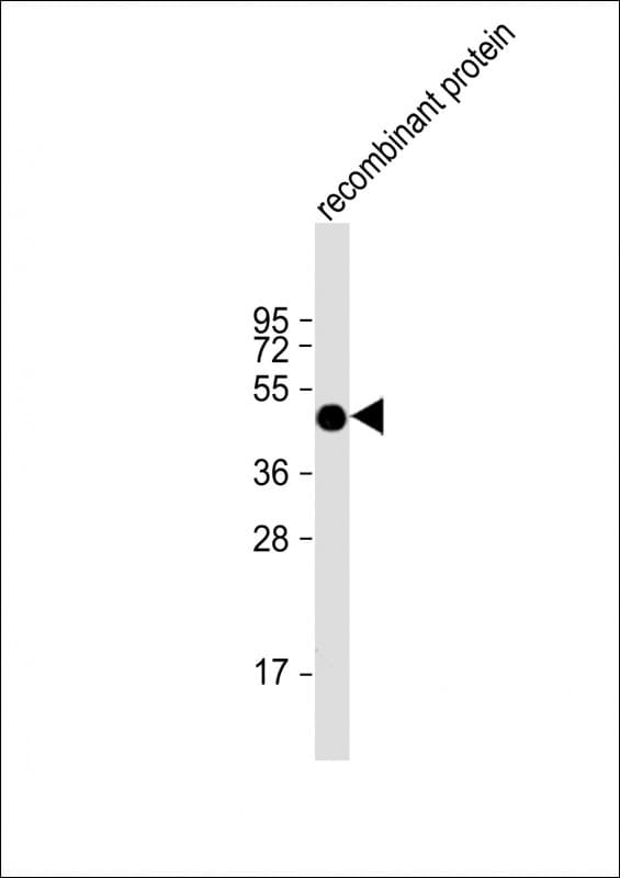 FAT1 / FAT Antibody (aa4203-4539, clone 1634CT464.1.9)