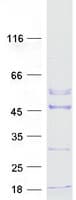 Human ACTRT2 Protein (Recombinant Myc-DDK (Flag))