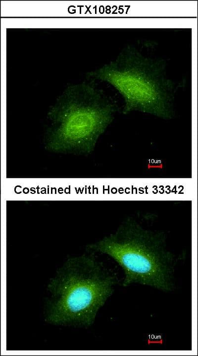 CR6 / GADD45G Antibody (aa96-159)