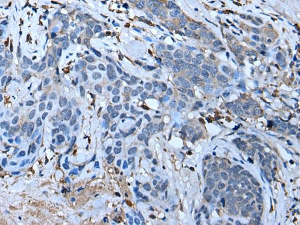 F3 / CD142 / Tissue factor Antibody