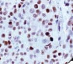 TP53 / p53 Antibody (clone DO7)