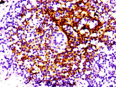 Recombinant Monoclonal Rabbit anti-Human CR2 / CD21 Antibody (IHC, IF, WB)