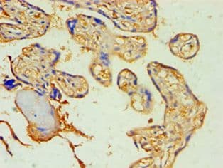 Polyclonal Rabbit anti-Human SOCS2 Antibody (aa1-198, IHC, WB)