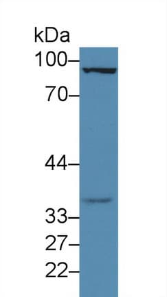 FOXM1 Antibody (aa209-460)