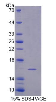 Human SEMA3C / Semaphorin 3C Protein (Recombinant His)
