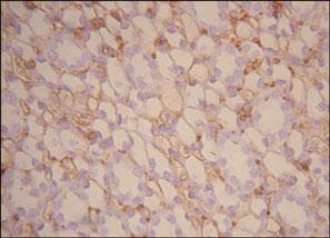 CD34 Antibody