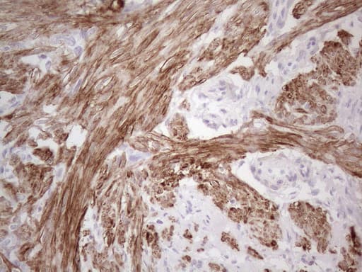 SPATA22 Antibody (clone OTI1E2)