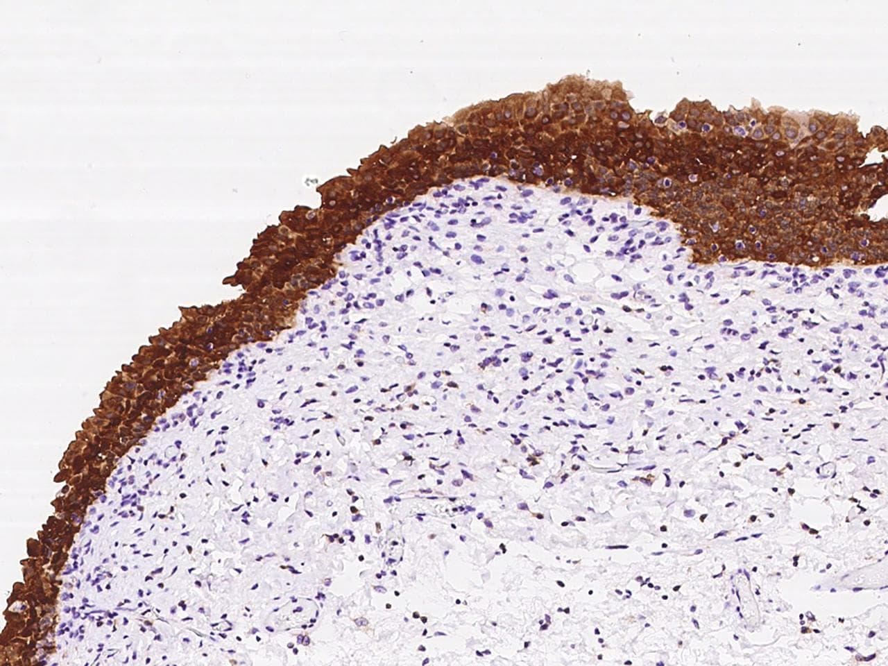 Polyclonal Rabbit anti-Human PADI3 Antibody (IHC)