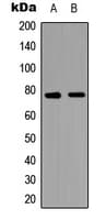 MAP3K7 / TAK1 Antibody (Internal)