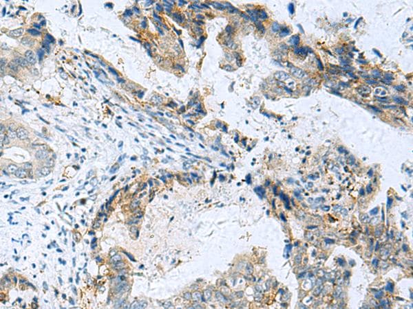 Polyclonal Rabbit anti-Human FAM82A1 Antibody (IHC)
