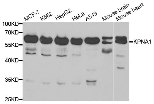 KPNA1 / Importin Alpha 5 Antibody