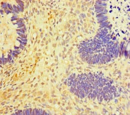 Polyclonal Rabbit anti-Human RNF20 Antibody (IHC)
