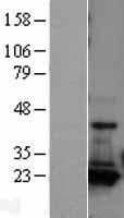 AK1 / Adenylate Kinase 1 Protein (Over-Expression Lysate Myc-DDK (Flag))