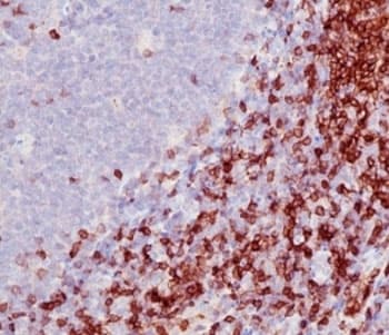 Monoclonal Mouse anti-Human CD5 Antibody (clone SPM546, IHC, IF)