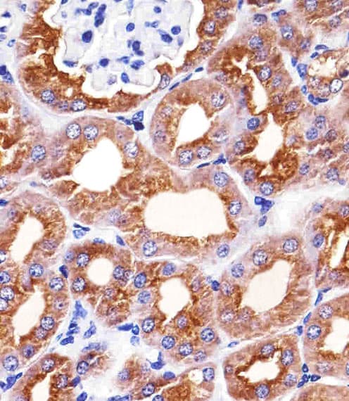 PH / PAH Antibody (aa127-161, clone 717CT21.1.1)