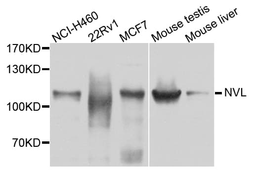 Polyclonal Rabbit anti-Human NVL Antibody (WB)