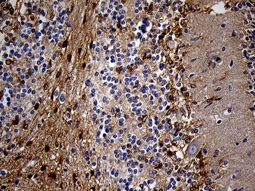 PYGM Antibody (aa698-842, clone OTI5D1)