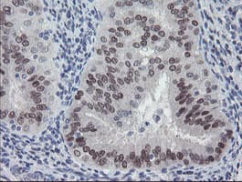 Monoclonal Mouse anti-Human MEIS3 Antibody (clone OTI3C9, IHC, WB)