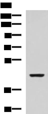 ISL2 / Islet 2 Antibody
