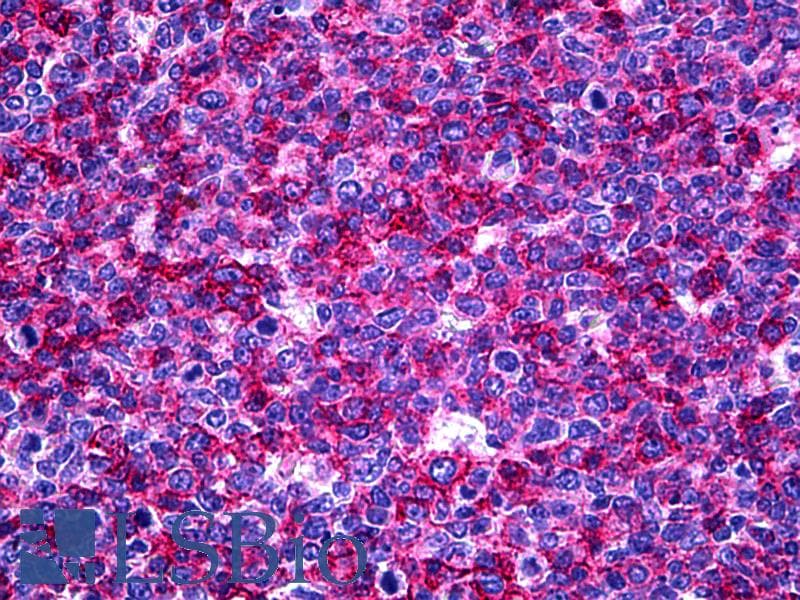 IHC-plus™ Monoclonal Mouse anti-Human USP33 / VDU1 Antibody (clone 5B5, IHC, IF, WB)