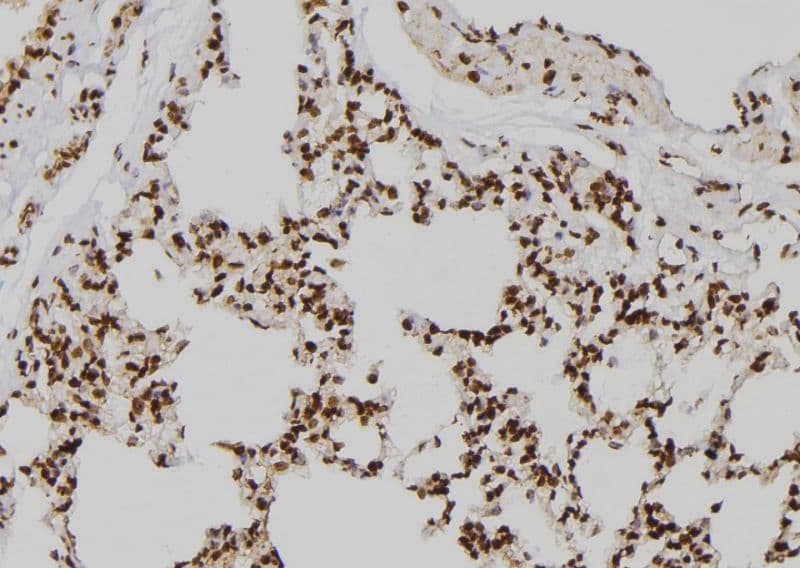 Polyclonal Rabbit anti-Human KDM4D / JMJD2D Antibody (IHC, WB)