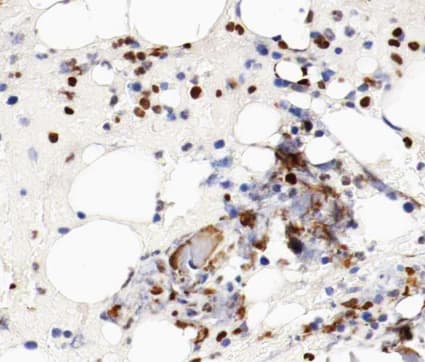 Polyclonal Rabbit anti-Human MCM5 Antibody (IHC, IF, WB)