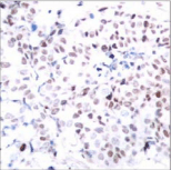 MYC / c-Myc Antibody